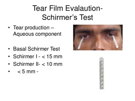 schirmer's tear test|schirmer test with anesthetic.